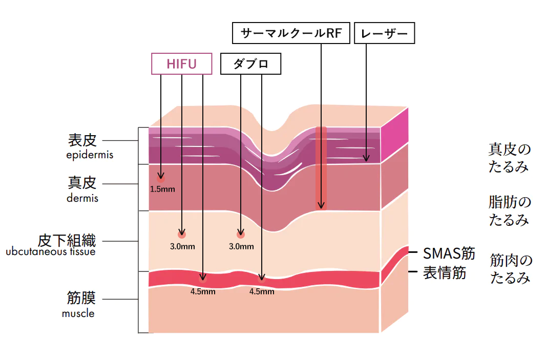 新世代ハイフ